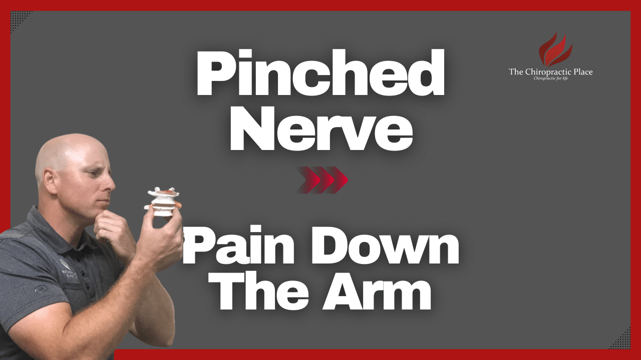 pinched-nerve-pain-down-the-arm-the-chiropractic-place